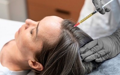 Exosome Therapy Riyadh’s Answer to Advanced Hair Loss Solutions